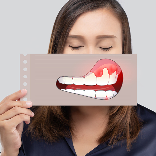 Paradontitistherapie - junge Frau mit Zeichnung von Zahnfleisch vor dem Mund